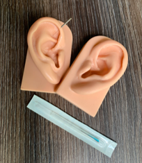 Intersection of Medical Acupuncture and Neurology